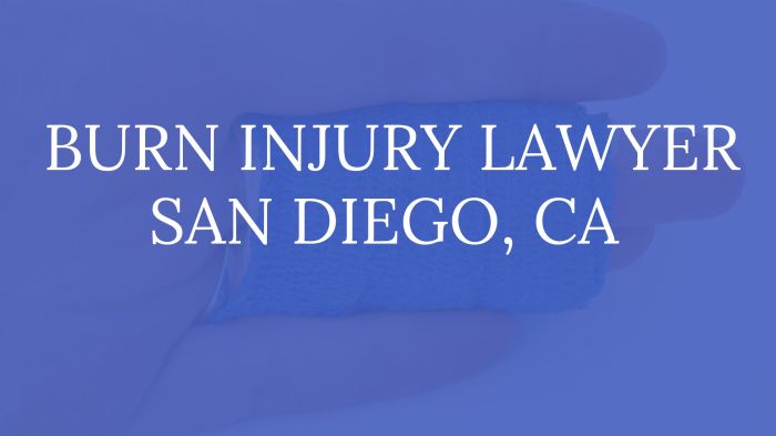 Injury lawyer san diego ca