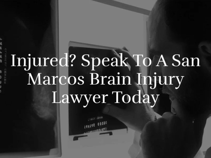 San diego brain injury lawyer