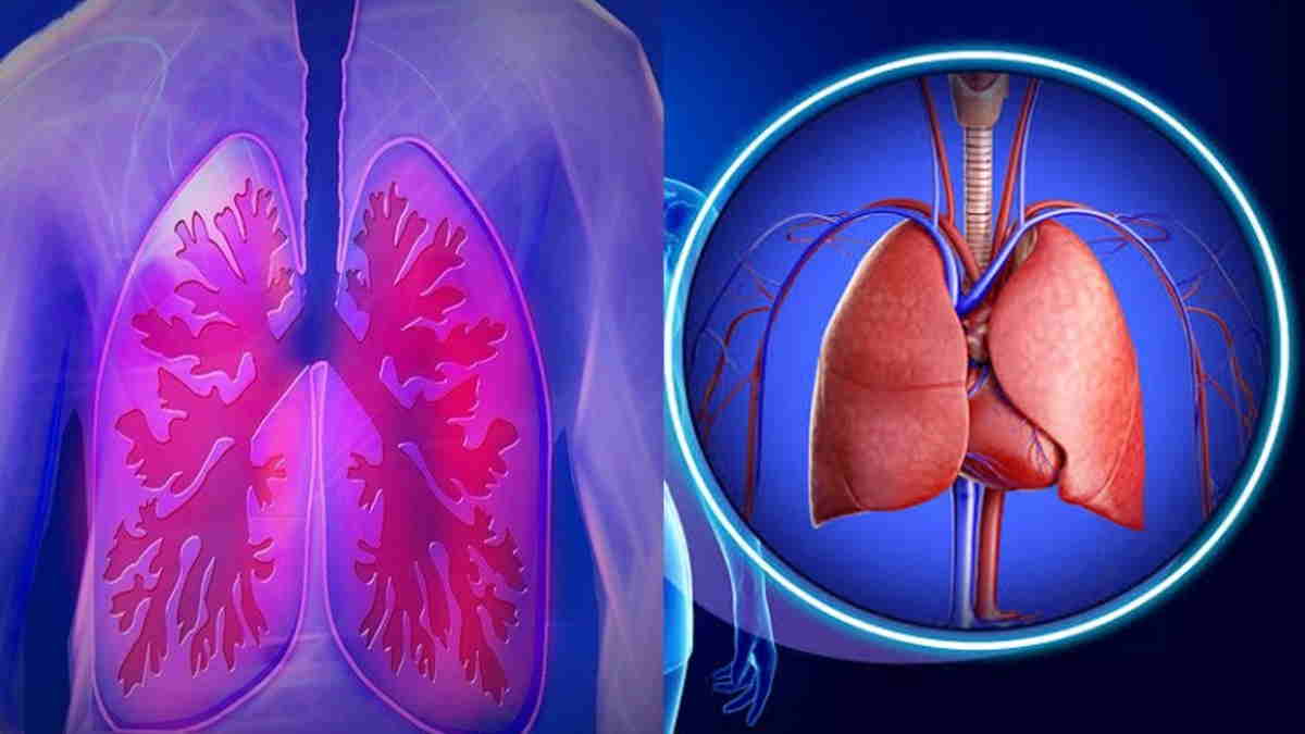 paru penyakit radang sebabkan oleh mancari pengobatan alami mengobati bakteri obat