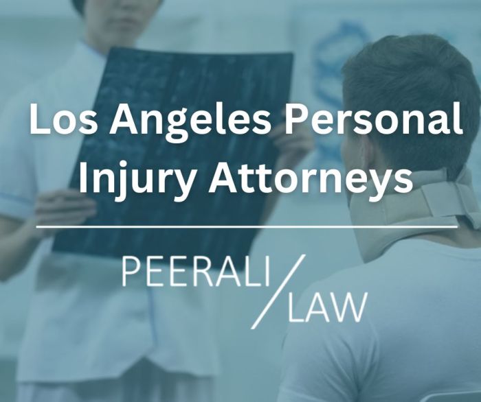 San mateo personal injury lawyer